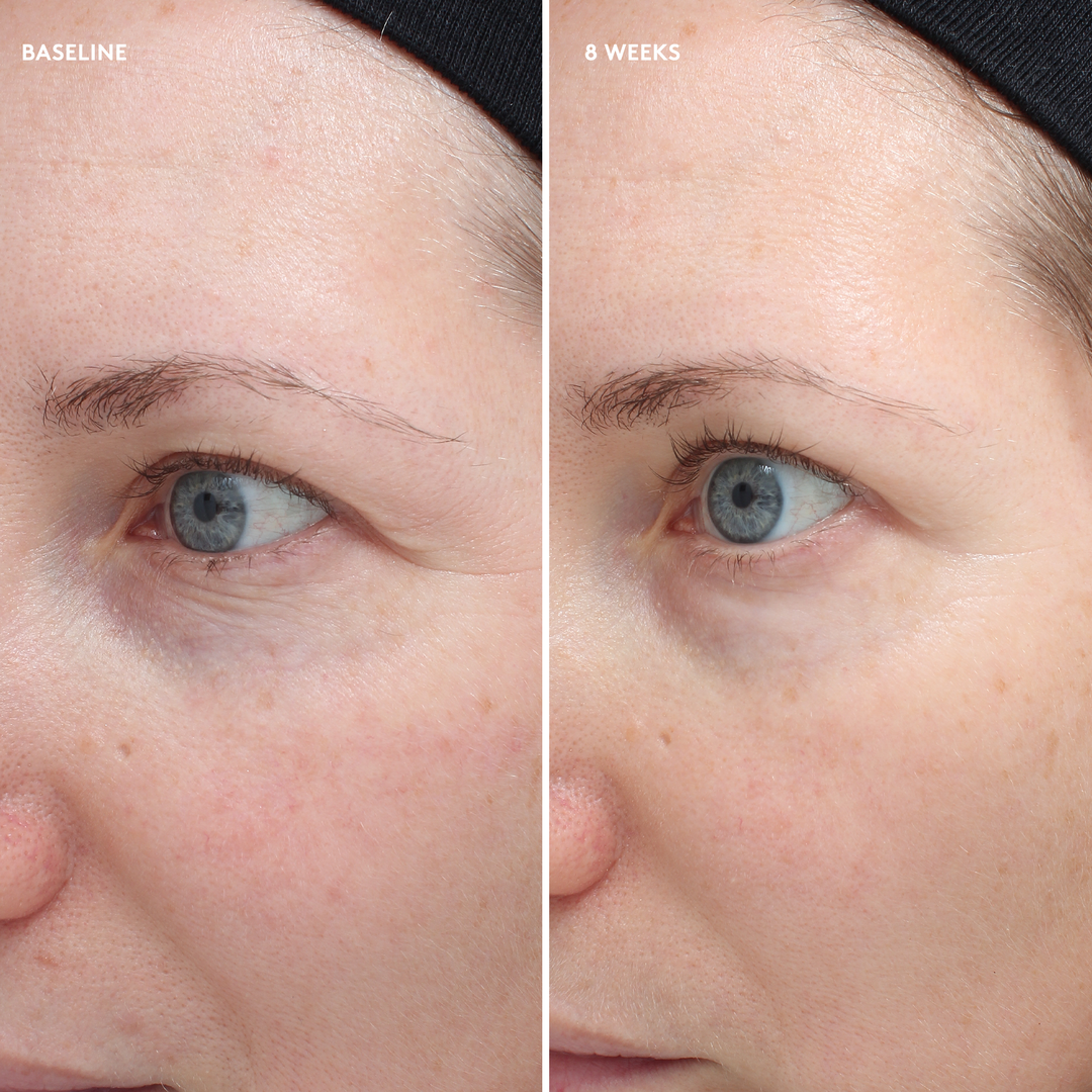 Colorescience - TOTAL EYE Crème Firm & Repair
