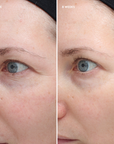 Colorescience - TOTAL EYE Crème Firm & Repair