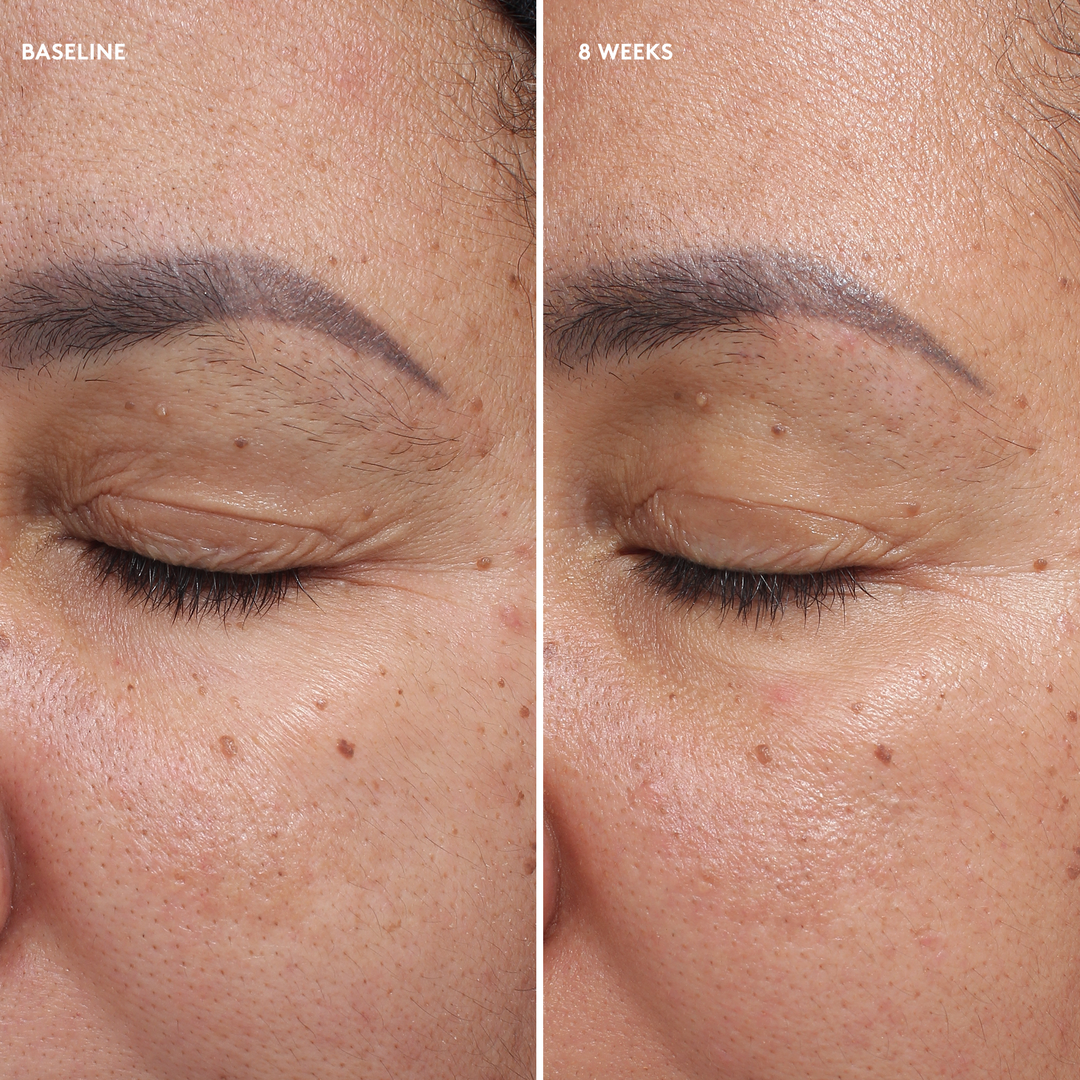 Colorescience - TOTAL EYE Crème Firm & Repair